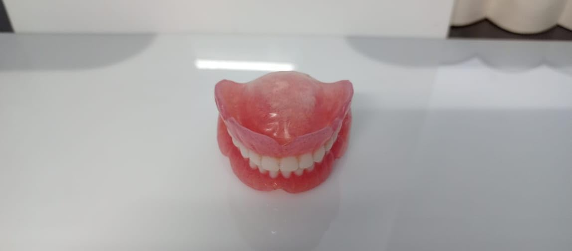 Full Set Upper & Lower Denture J675