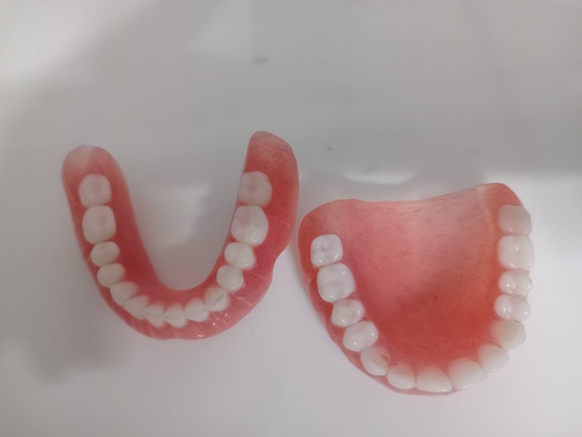 Full Set Upper & Lower Denture J675