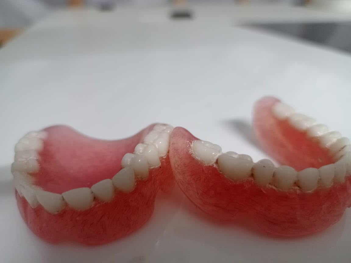 Full Set Upper & Lower Denture J675