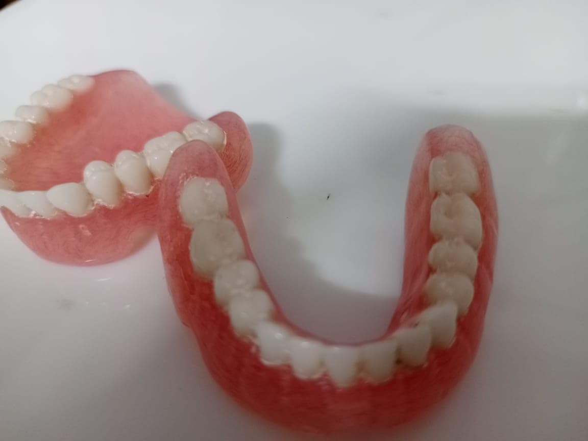 Full Set Upper & Lower Denture J675