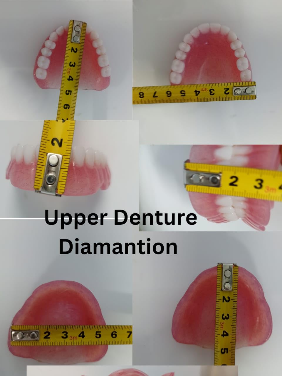 Full Set Upper & Lower Denture J675
